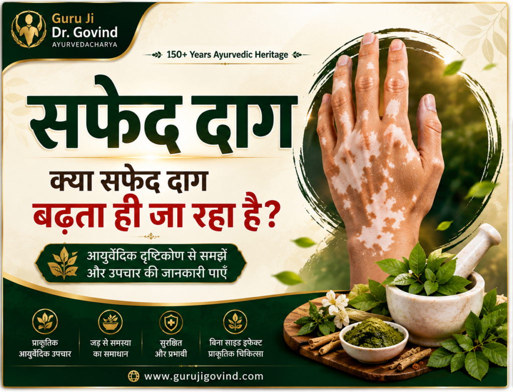 Vitiligo- Gurujigovind