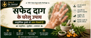 सफेद दाग के घरेलू उपाय: आयुर्वेदिक नुस्खे जो असर दिखाते हैं- Guruji Dr. Govind