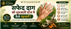 सफेद दाग को शुरुआती स्टेज में कैसे पहचानें?- Guruji Dr. Govind